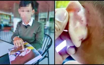 Khởi tố cô giáo mầm non đánh trẻ gây thương tích ở Kiên Giang