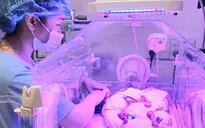 Nuôi sống thành công bé sinh non hơn 24 tuần