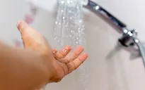 Kì lạ người phụ nữ bị dị ứng với nước