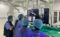 Xuất huyết não cấp tính do vỡ phình động mạch