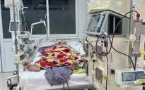 Lọc máu liên tục cứu sống người bệnh sốc nhiễm khuẩn, suy đa tạng, viêm phổi nặng
