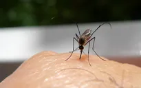 Bác sĩ da liễu giải thích nguyên nhân khiến một số người bị muỗi đốt nhiều hơn
