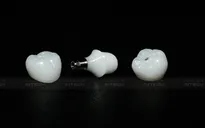 Sai lầm phổ biến khi trồng răng implant