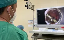 Gắp cây đinh ốc trong tá tràng bé trai 2 tuổi