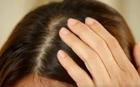 Những yếu tố gây ra tóc bạc