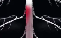 Công nghệ kích thích tủy sống giúp bệnh nhân Parkinson đi lại