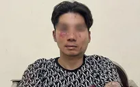 Cầm dao xông vào quán ốc cướp tiền, đâm thương tích công an