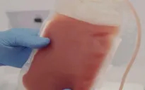 Mỹ phê duyệt liệu pháp gen điều trị bệnh hồng cầu hình liềm