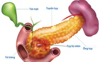 Nguy hiểm bệnh viêm tụy cấp