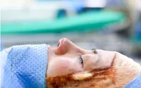 Những biến chứng của trào lưu nâng mũi cấu trúc