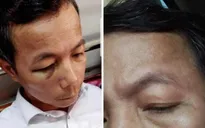Xác minh vụ Hiệu trưởng đánh Phó Hiệu trưởng nhập viện