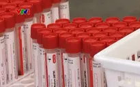 Xét nghiệm nước thải, xác định xu hướng dịch COVID-19 tại Hàn Quốc