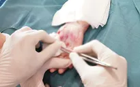 3 trẻ bị bỏng nặng do máy chạy bộ - Khuyến cáo an toàn cha mẹ nên lưu ý
