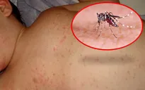 Phòng tránh sốt xuất huyết từ ý thức mỗi người dân