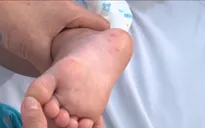 Đảm bảo cung ứng thuốc điều trị bệnh tay chân miệng
