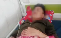Nhân viên bảo vệ rừng bị hành hung phải nhập viện