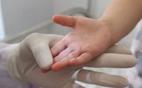 TP. Hồ Chí Minh chỉ đạo tăng cường phòng chống bệnh tay chân miệng