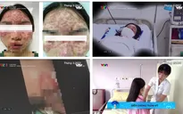 Thẩm mỹ "chui": Biến tướng lừa đảo và biến chứng cho khách hàng