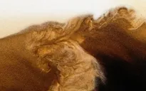 Sử dụng đồ uống có cồn quá nhiều làm tăng tốc độ mắc Alzheimer