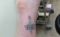 Xóa xăm hậu chia tay