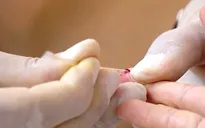 Đắk Lắk khuyến cáo phòng tránh lây nhiễm HIV