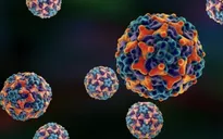 Sở Y tế TP. Hồ Chí Minh: Coxsackievirus A24 là tác nhân chính gây bùng phát bệnh đau mắt đỏ