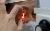 Nêu cao ý thức phòng bệnh và xử trí kịp thời khi đau mắt đỏ