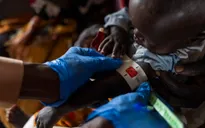 Dịch sởi và tình trạng suy dinh dưỡng khiến hơn 1.200 trẻ em ở Sudan tử vong