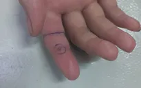 Chơi ở sân nhà, 2 bé gái sinh đôi bị rắn hổ mang cắn