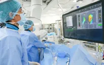 Đột quỵ do biến chứng rung nhĩ