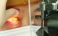 Nguy cơ bùng phát dịch đau mắt đỏ