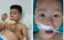 Tiếp vụ hai cháu bé ở Thanh Hóa hôn mê sau ăn bim bim lạ: Chuyển biến tích cực