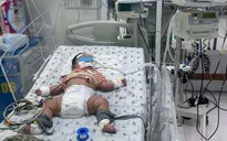Cứu bé trai sốc sốt xuất huyết biến chứng suy hô hấp, tổn thương gan nặng