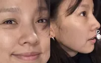 Lee Hyori chấp nhận sự lão hóa của tuổi tác, không ngại khoe nếp nhăn