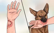 Đồng Nai: 2 người bị chó dại vô chủ cắn