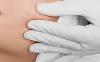 Một người phụ nữ tử vong sau phẫu thuật thẩm mỹ