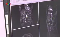 Trung Quốc đưa vào sử dụng máy xạ trị cộng hưởng từ đầu tiên