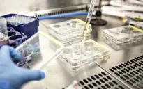 Nga đang hoàn tất các thử nghiệm vaccine chống ung thư