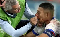 Mbappé đang gặp khó khăn với việc thay đổi mặt nạ liên tục trong các trận đấu