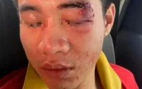 Điều tra vụ nam nhân viên nhà xe ở Hà Nội bị đánh hội đồng