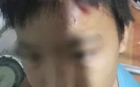 Nghi ngờ mẹ kế tiếp tục bạo hành con trai 10 tuổi sau khi hưởng 9 tháng tù treo