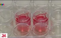 Da trong phòng thí nghiệm - hy vọng mới cho bệnh nhân Eczema