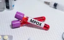 Trẻ em tại các trại tị nạn ở Congo trước nguy cơ nhiễm biến thể đậu mùa khỉ