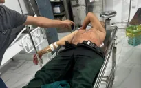 Tài xế "xe ôm" may mắn thoát chết sau khi bị đâm nhiều nhát vào người