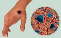 Trung Quốc đóng cửa trang trại gia súc do phát hiện một số ca bệnh than