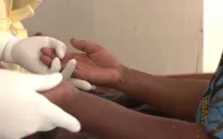 Ứng phó với biến thể đậu mùa khỉ mới