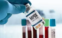Đức tặng 100.000 liều vaccine đậu mùa khỉ cho châu Phi