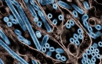 Anh chuẩn bị 5 triệu liều vaccine phòng ngừa đại dịch cúm gia cầm