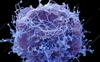 Nga xác định nhóm nguy cơ nhiễm virus HMPV gây bệnh đường hô hấp