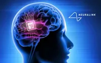 Người đầu tiên được cấy chip não của Neuralink giờ ra sao?
